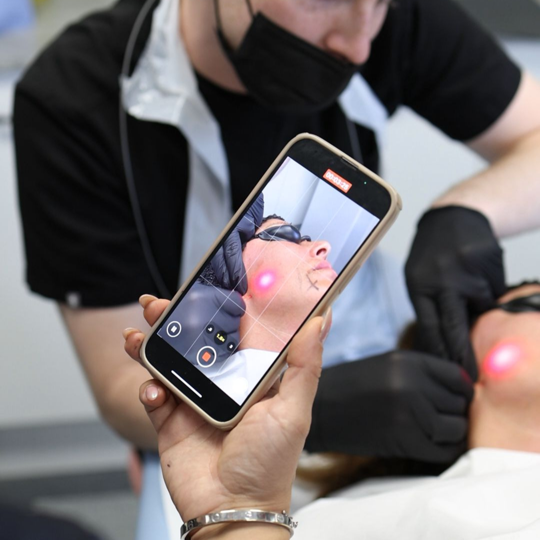 Endolift vs EndoPulse: Which Laser System is Right for Your Clinic?