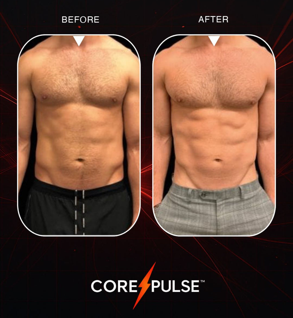CorePulse™ Machine