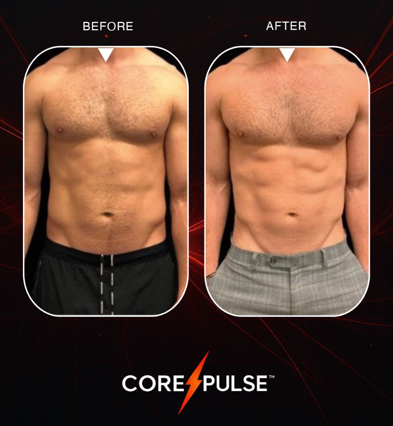 CorePulse™ Machine