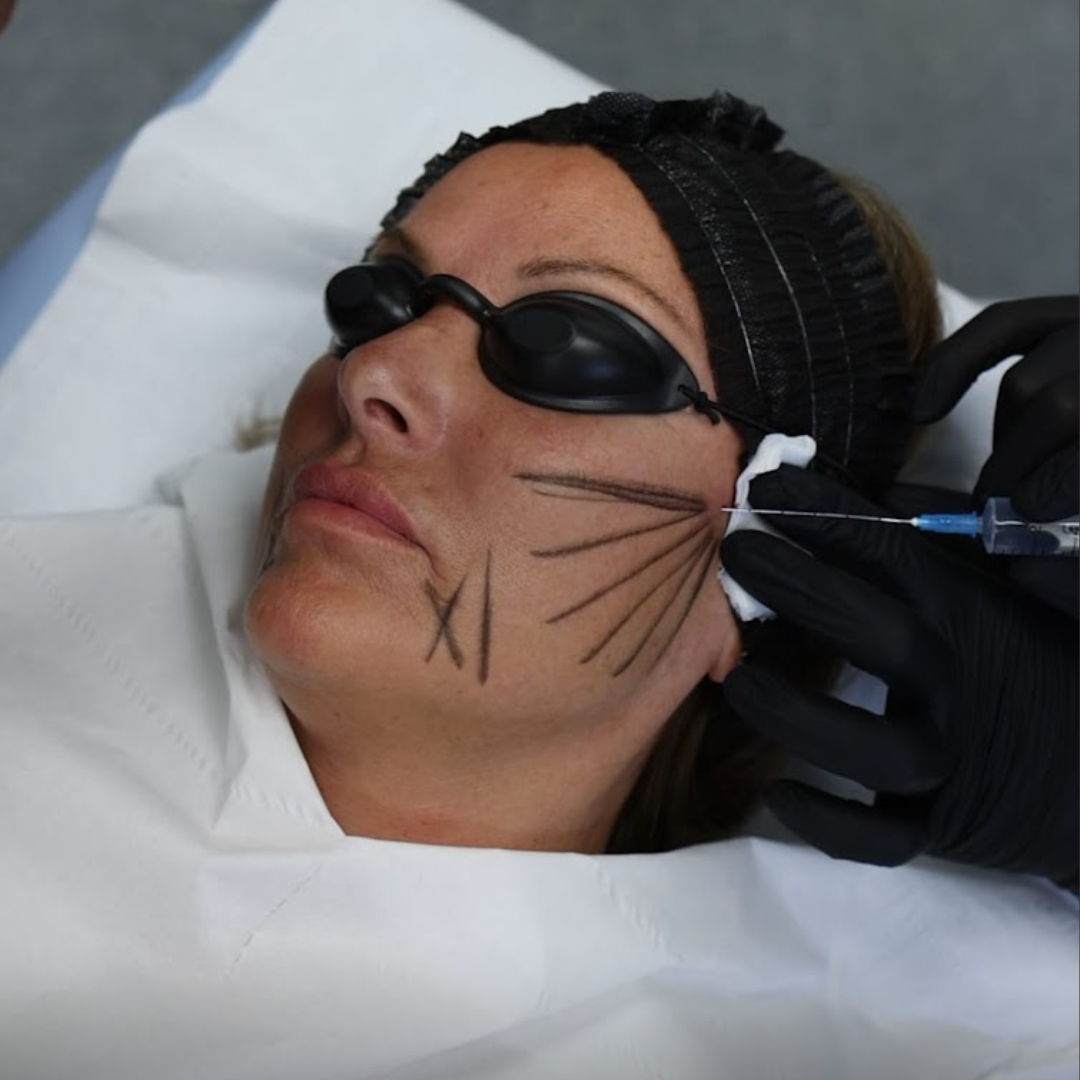 EndoPulse Training Course