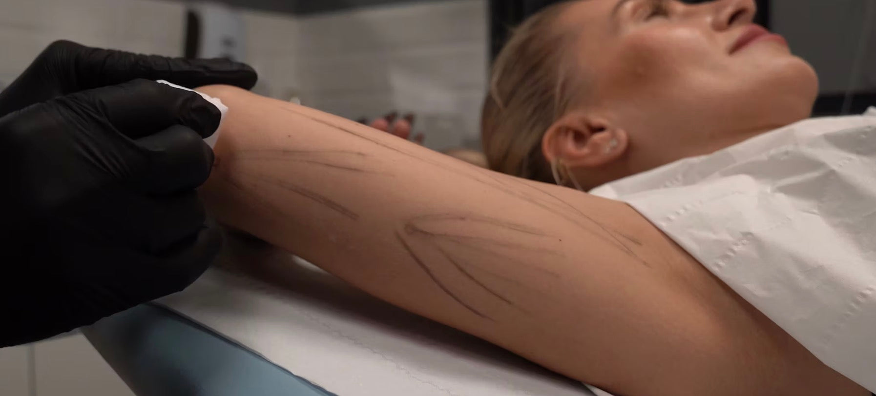 EndoPulse™ Educational Video - Arm Demonstration