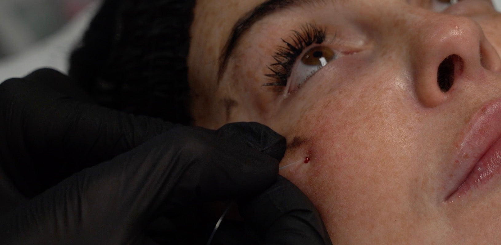 EndoPulse™ Educational Video - Eye Demonstration